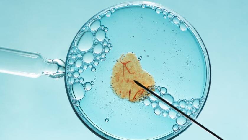Intrauterine Insemination (IUI)