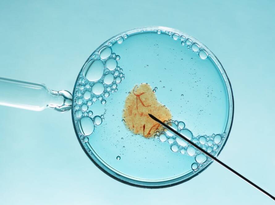 Intrauterine Insemination (IUI)