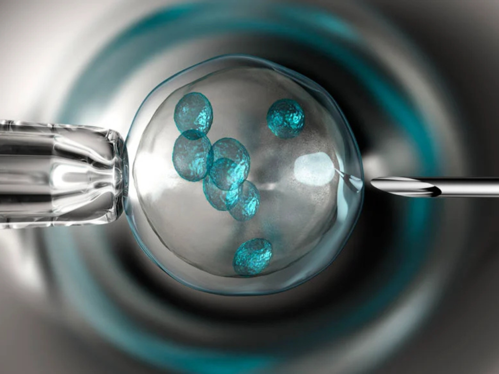 In Vitro Maturation (IVM)