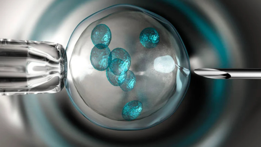 In Vitro Maturation (IVM)
