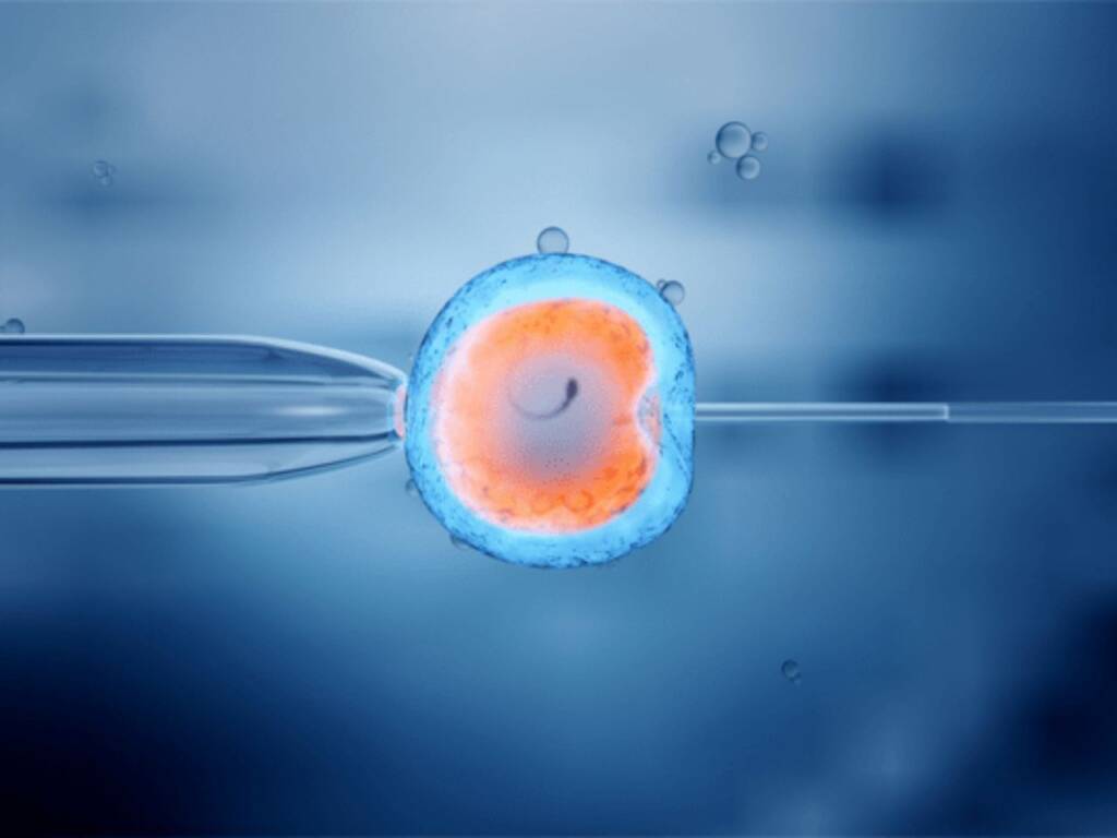In Vitro Fertilization (IVF)