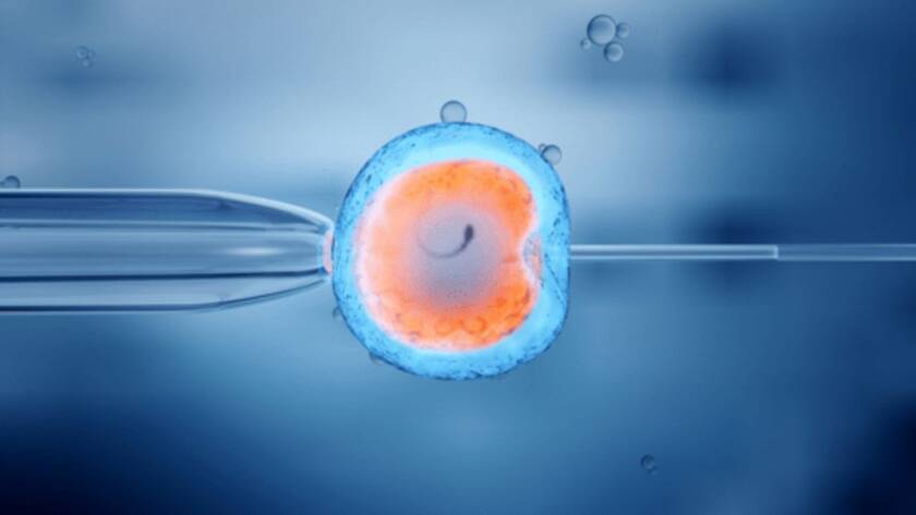 In Vitro Fertilization (IVF)