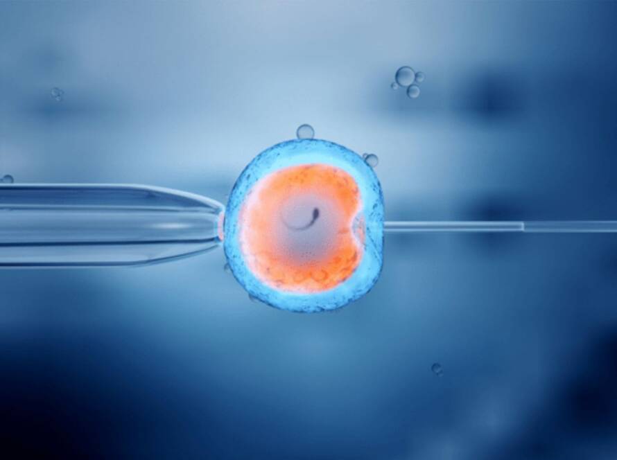 In Vitro Fertilization (IVF)