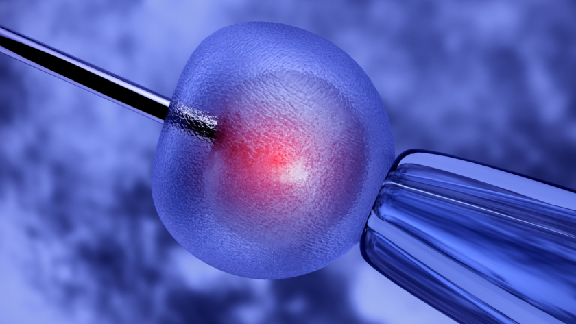 Intracytoplasmic Sperm Injection (ICSI)