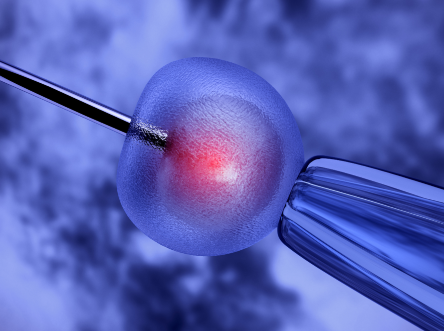 Intracytoplasmic Sperm Injection (ICSI)