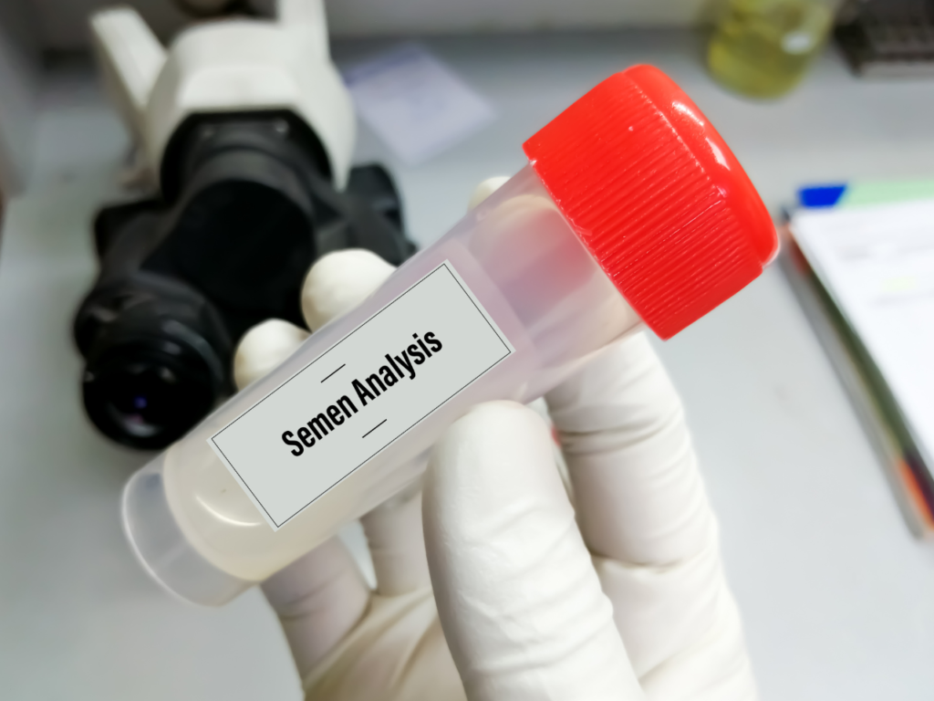 Semen Analysis