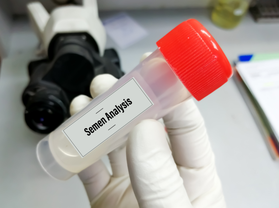 Semen Analysis