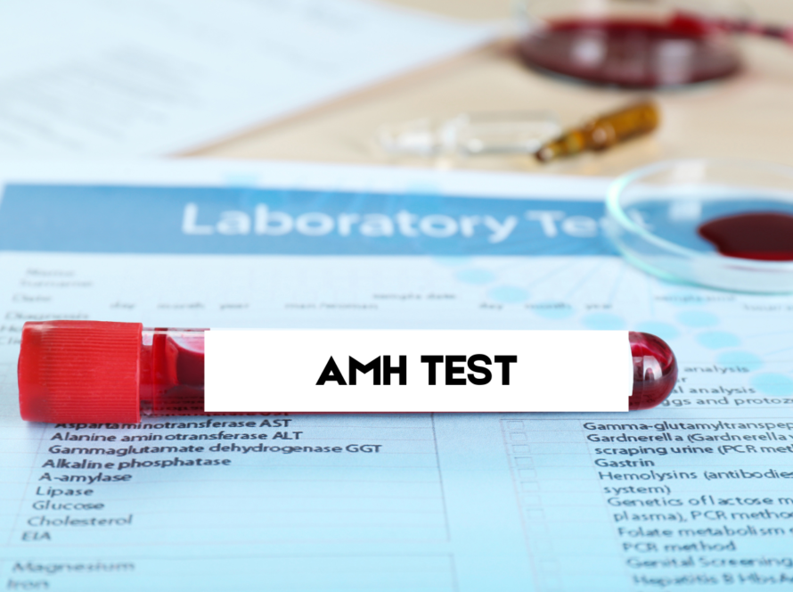 AMH TEST