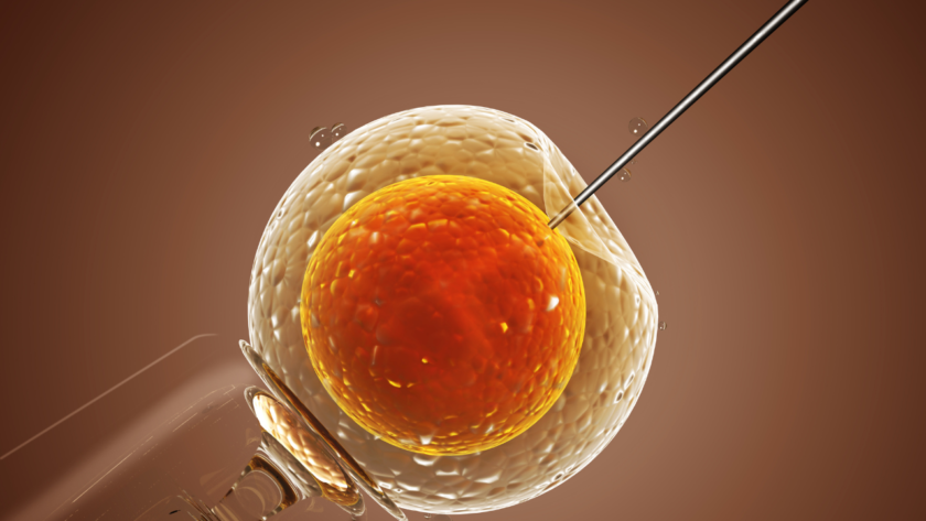 IUI Treatment