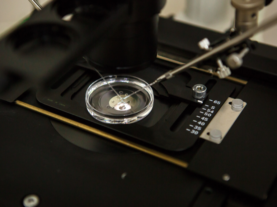 How to Prepare Your Body for IVF