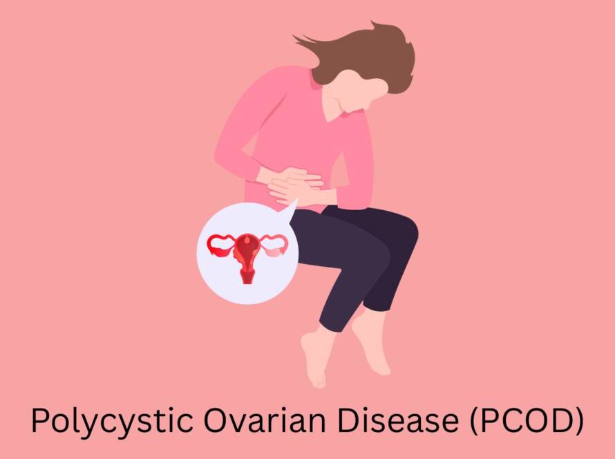 PCOD