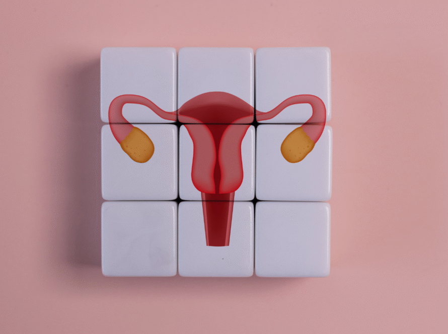 Home Remedies for PCOS and How They Impact Your Fertility